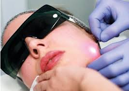 Endolift laser in Tunisia