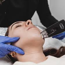 FaceTite face tightening Tunisia
