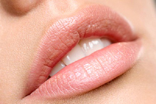 PermaLip lip implants - plumping lips in Tunisia