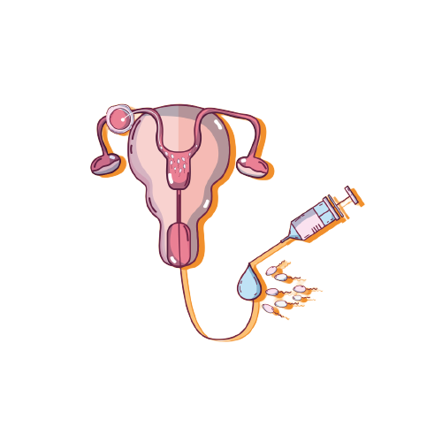 Artificial insemination - Medically Assisted Reproduction in Tunisia