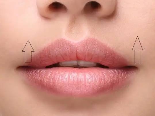 Lip Lift - Treatment in Tunisia