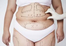Full HD Liposuction muscle contouring treatment Tunisia