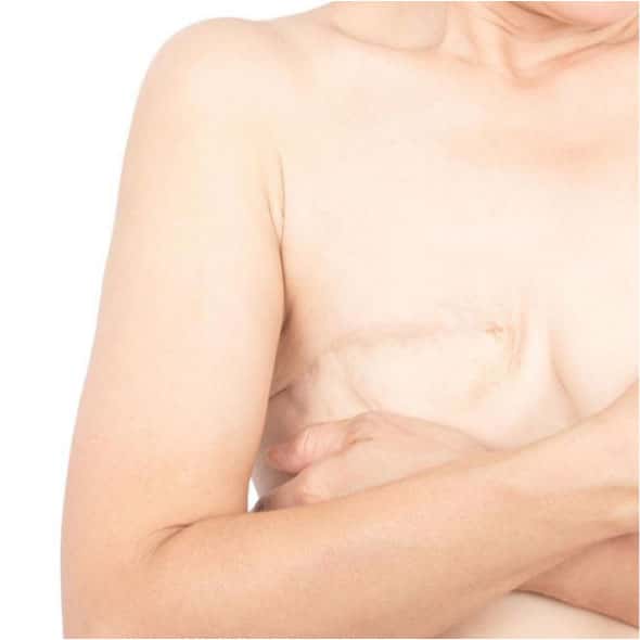 Partial or total mastectomy in Tunisia at a cheap price