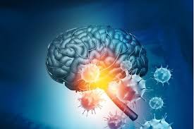 Meningitis Tunisia - Diagnosis and treatment