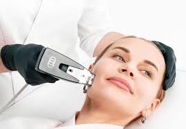 Morpheus 8 skin rejuvenation treatment Tunisia