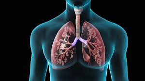 Hypoxemic pneumonia Tunisia - Oxygen therapy and mechanical ventilation