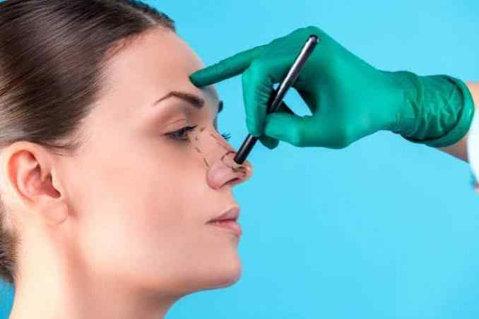 Structural Rhinoplasty - Treatment in Tunisia