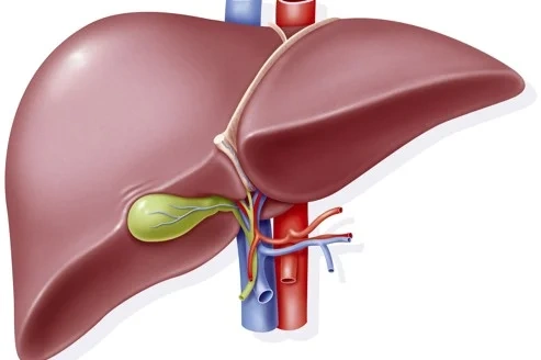 Cholecystectomy in Tunisia - Gallbladder removal